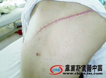 女大学生因感情不和提分手遭男友割喉(图)